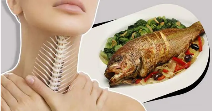 Sticking fish in the throat while eating