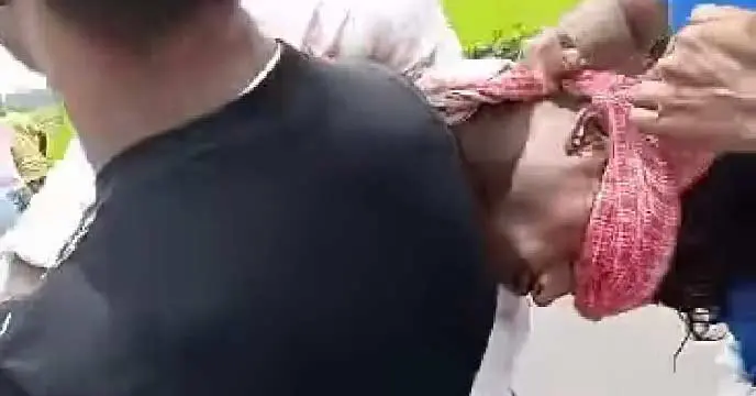 Commission Besieged as Bloody CPIM Supporter Runs with Shot Back in Chopra Attack