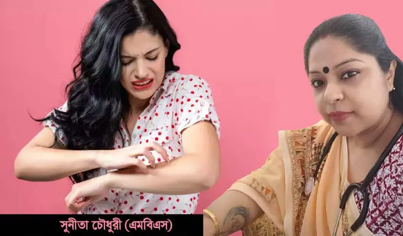 Five Homeopathy Medicines to Keep Close to Treat Heat Rash or Itching