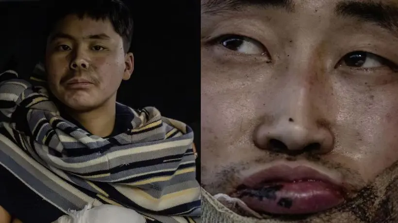 Russia-Ukraine War: Ukraine captures North Korean soldiers