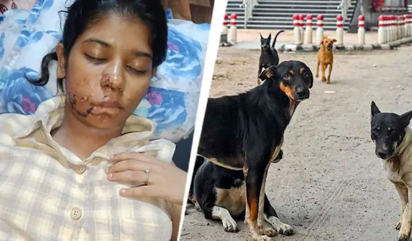Kanpur college girl stray dog attack