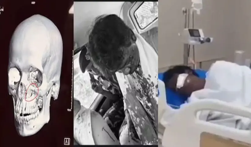 Khagen Murmu injured