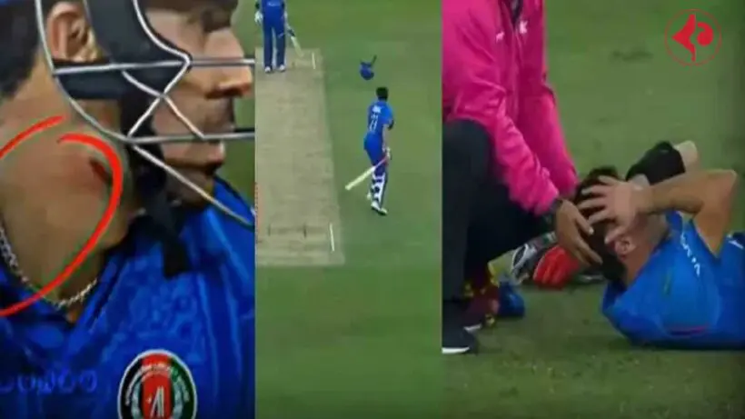 t20-world-cup-2026-rahmanullah-gurbaz-injury-viral-video