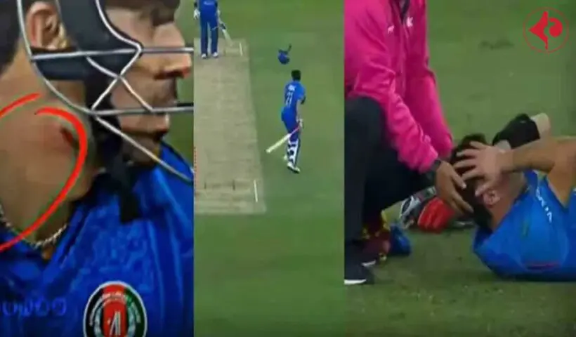 t20-world-cup-2026-rahmanullah-gurbaz-injury-viral-video