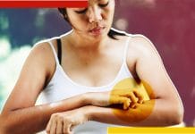 গর্ভবতীরা সাবধান হন, জেনে নিন কাদের রক্ত পান করতে ভালবাসে মশা mostly-mosquito-love-to-bite-whom