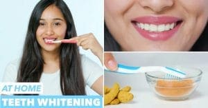 How to get rid of yellow teeth