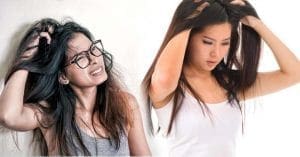 Home Remedies Itchy Scalp