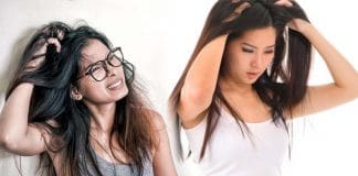 Home Remedies Itchy Scalp