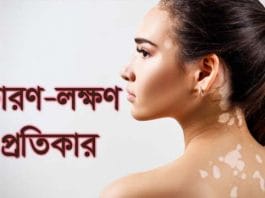 White Patches On Skin