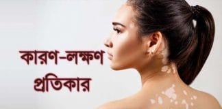 White Patches On Skin