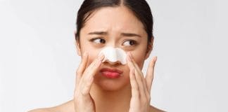 How To Get Rid of Blackheads Naturally
