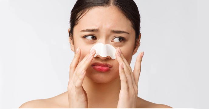 How To Get Rid of Blackheads Naturally