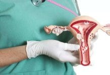 সার্ভিকাল ক্যান্সার পরীক্ষার ডিভাইস আবিস্কার করে বিশ্বে নজর রামানুজম