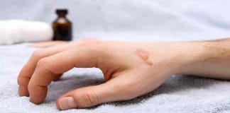 Revitalize Your Skin with Hot Oil Hand Treatment and Tea Leaf Application