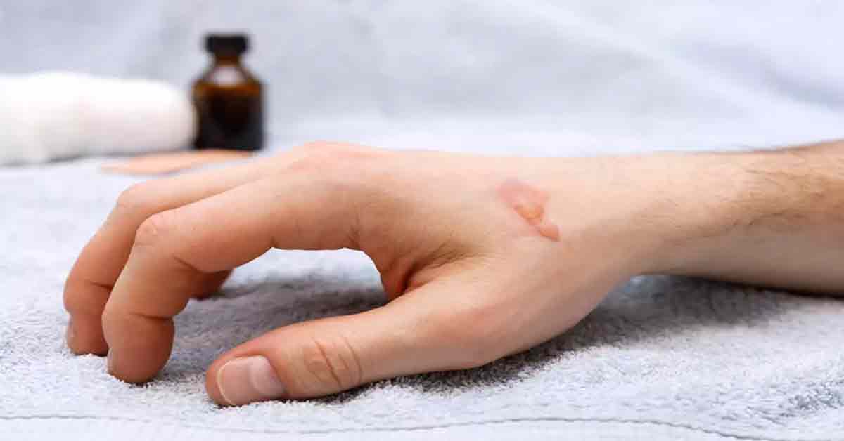 Revitalize Your Skin with Hot Oil Hand Treatment and Tea Leaf Application