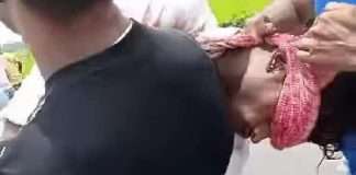 Commission Besieged as Bloody CPIM Supporter Runs with Shot Back in Chopra Attack