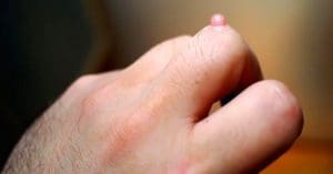 Skin Tips