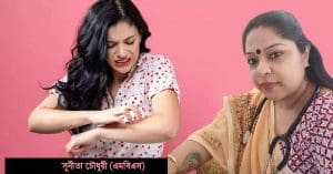 Five Homeopathy Medicines to Keep Close to Treat Heat Rash or Itching