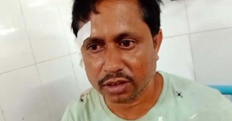 বিজেপির যুব মোর্চার কার্যকর্তার কান কেটে নেওয়া অভিযোগ! অভিযুক্ত তৃণমূল