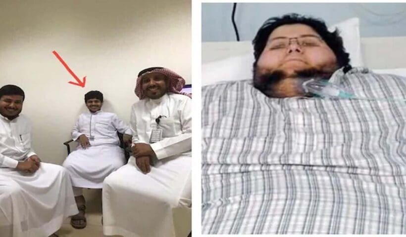 Saudi Man Khalid Bin Mohsen Shaari Loses Over 500 Kilos After Former King Steps In To Help, খালিদের নাটকীয় রূপান্তর, ৬১০ থেকে কমে এখন ৬৩.৬ কেজি!