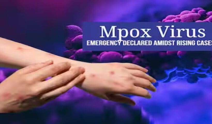 Monkey pox outbreaks india alart caution nationwide.