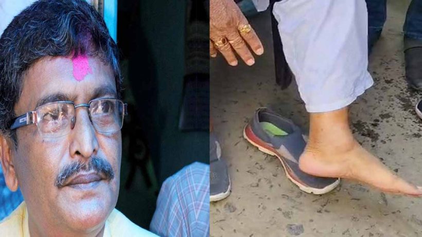 TMC MLA Foot Injury