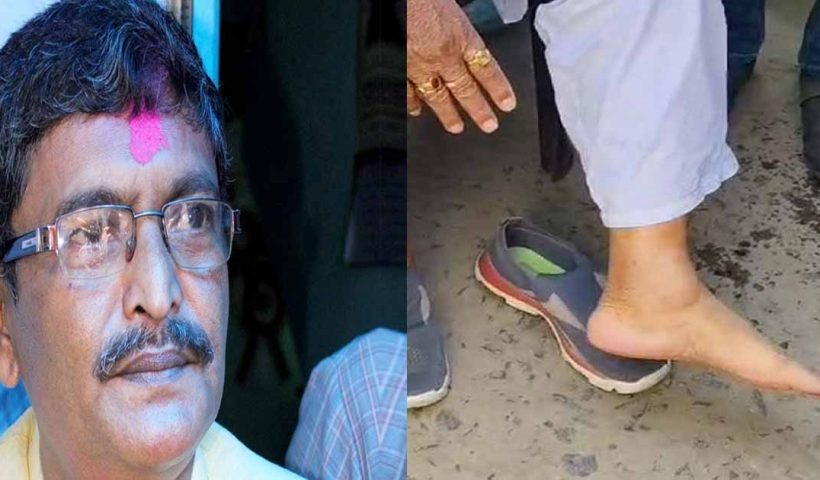 TMC MLA Foot Injury