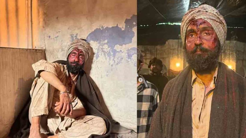 Diljit Dosanjh shared shocking photos with his face covered in blood, leaving fans curious and concerned. Discover the reason behind these viral images, related to his upcoming movie.