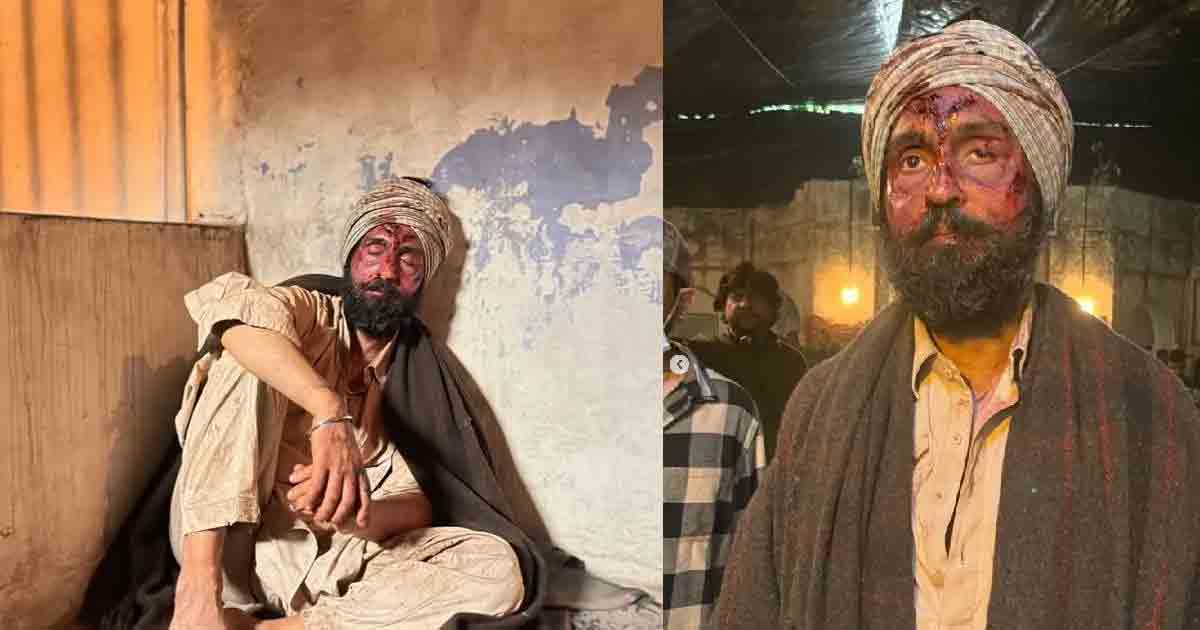 Diljit Dosanjh shared shocking photos with his face covered in blood, leaving fans curious and concerned. Discover the reason behind these viral images, related to his upcoming movie.