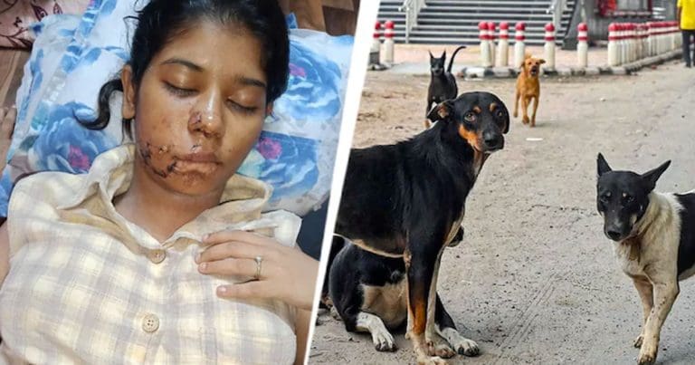 Kanpur college girl stray dog attack