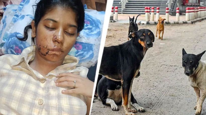 Kanpur college girl stray dog attack