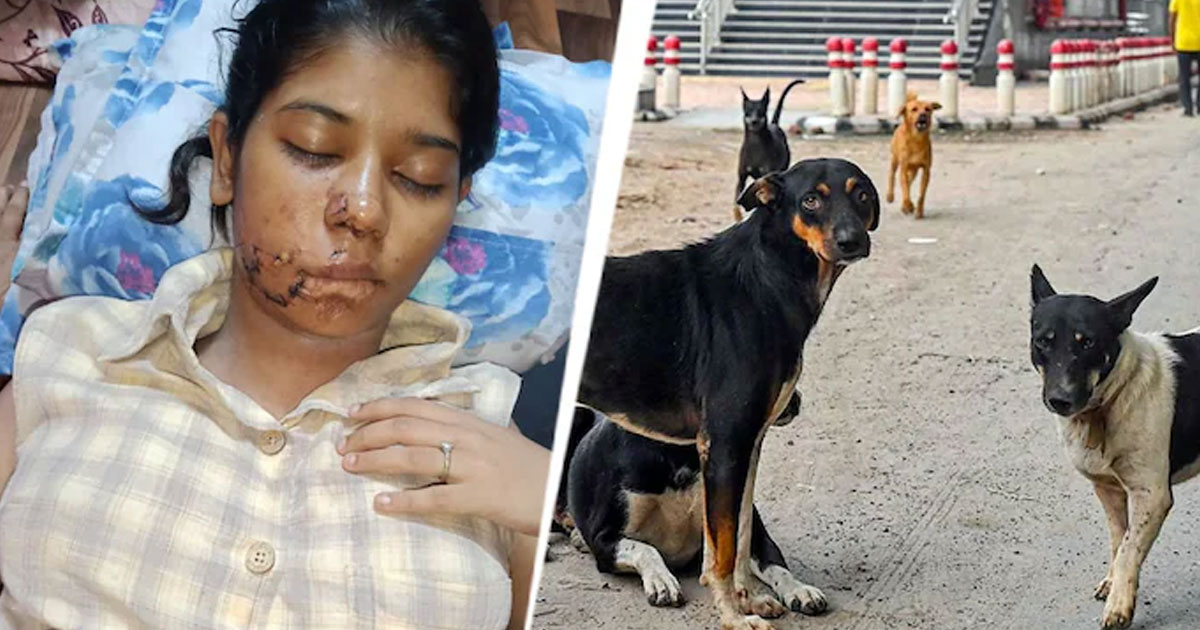 Kanpur college girl stray dog attack