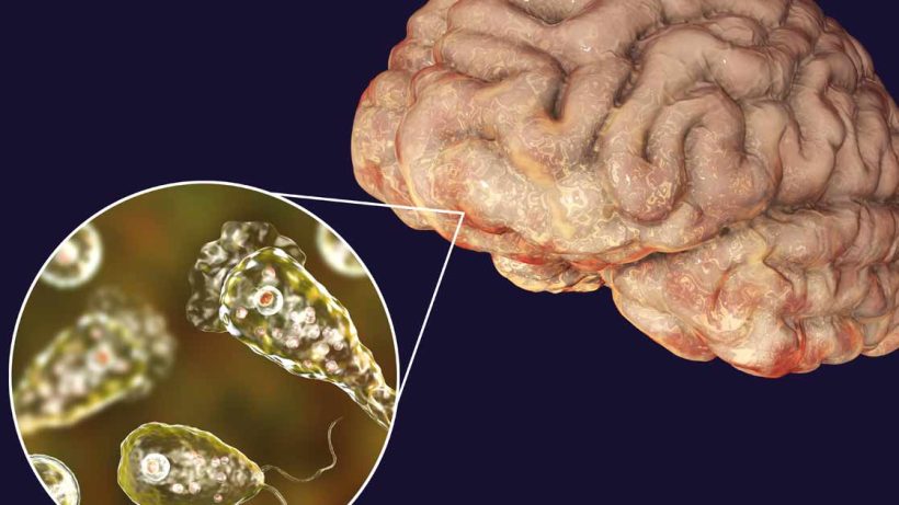 Brain Eating Amoeba