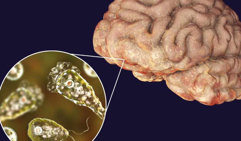 Brain Eating Amoeba