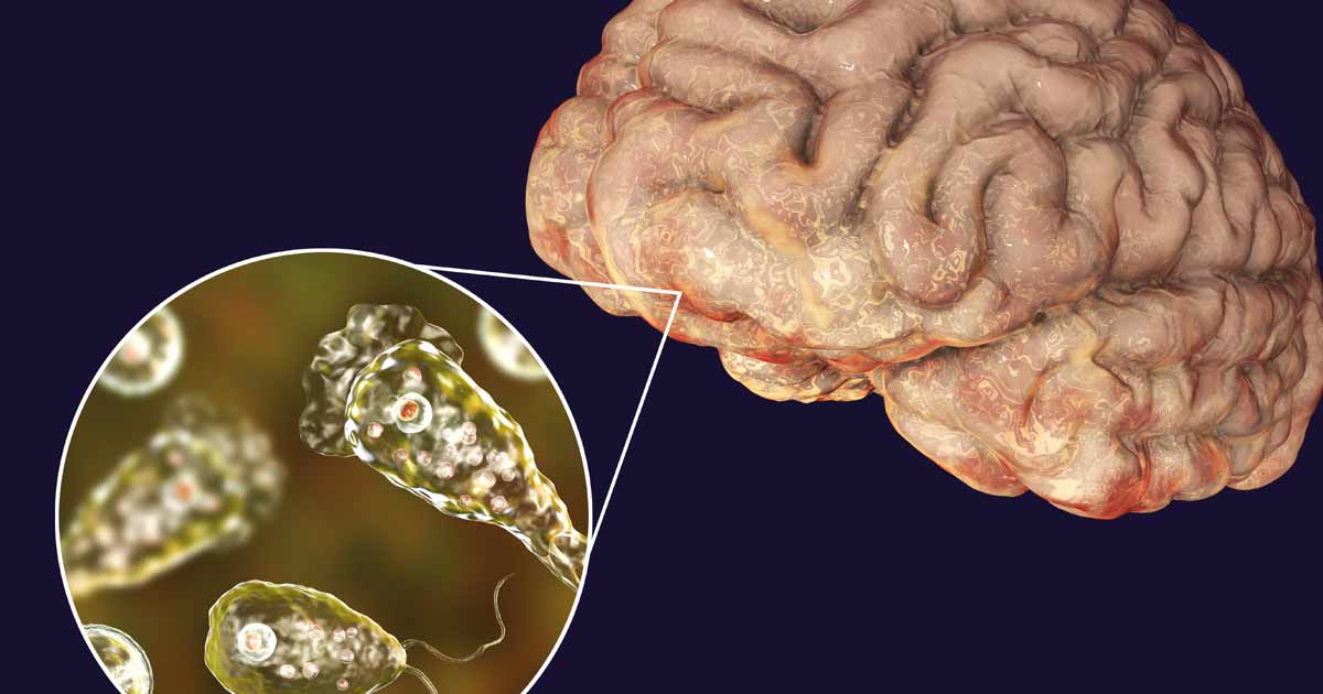 Brain Eating Amoeba
