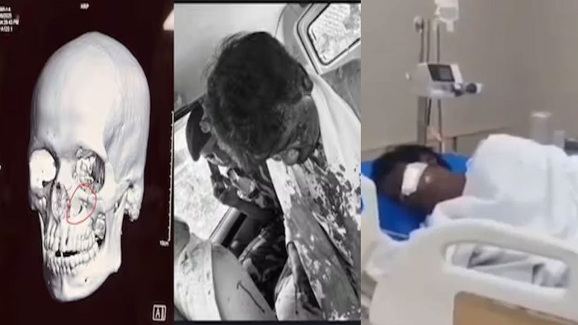 Khagen Murmu injured