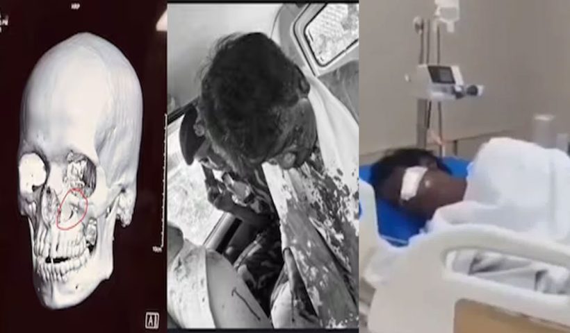 Khagen Murmu injured