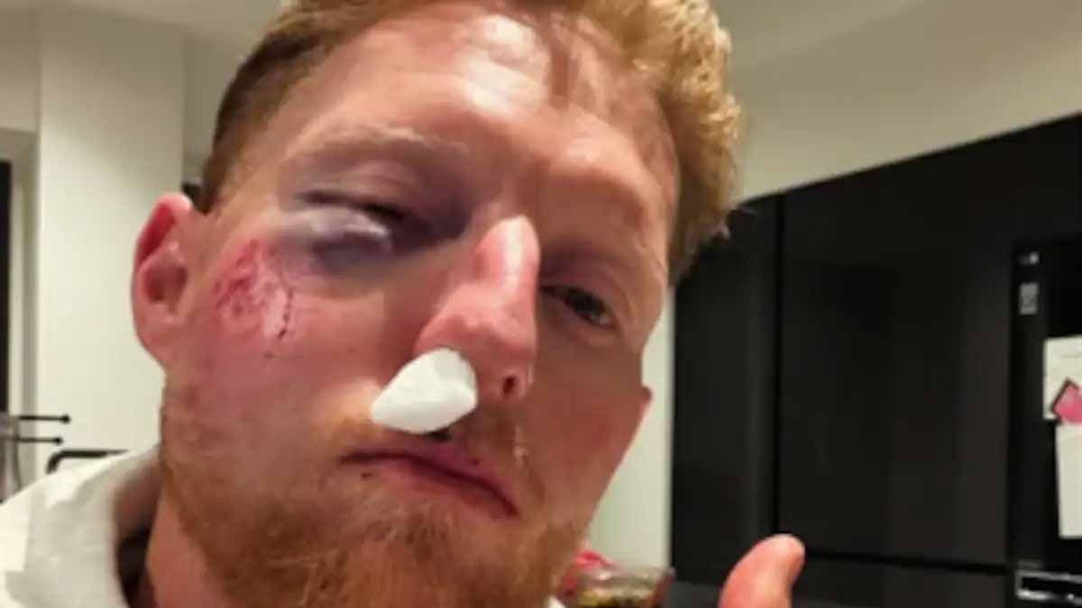 Ben Stokes Suffers Serious Injury ahead T20 World Cup