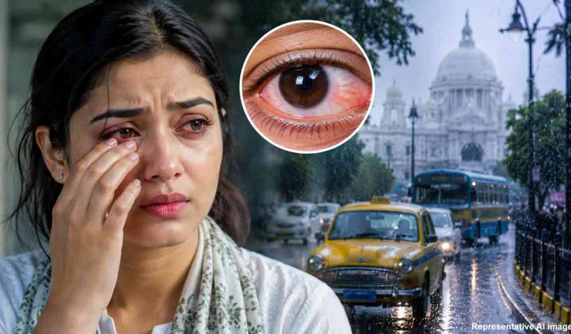 viral-allergic-conjunctivitis-cases-rise-in-kolkata-monsoon