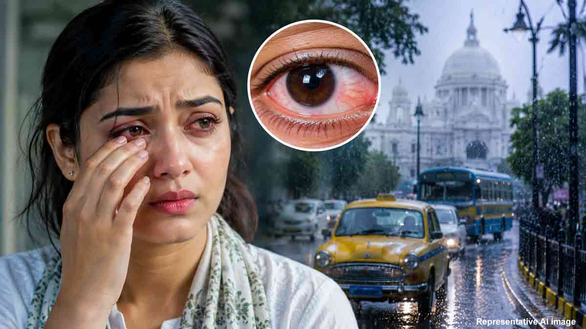 viral-allergic-conjunctivitis-cases-rise-in-kolkata-monsoon